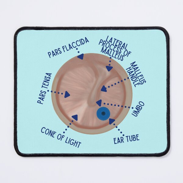 Item preview, Ear Drum with Ear Tube designed and sold by Hear4theEars.