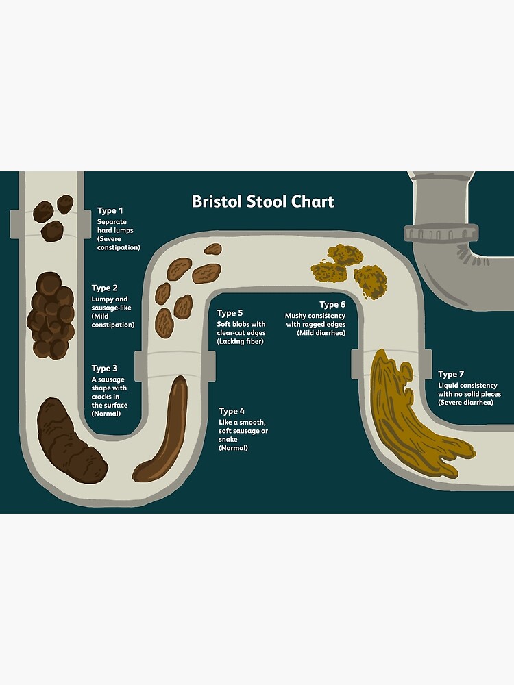 "Bristol stool chart" Poster for Sale by Glinda-39 | Redbubble