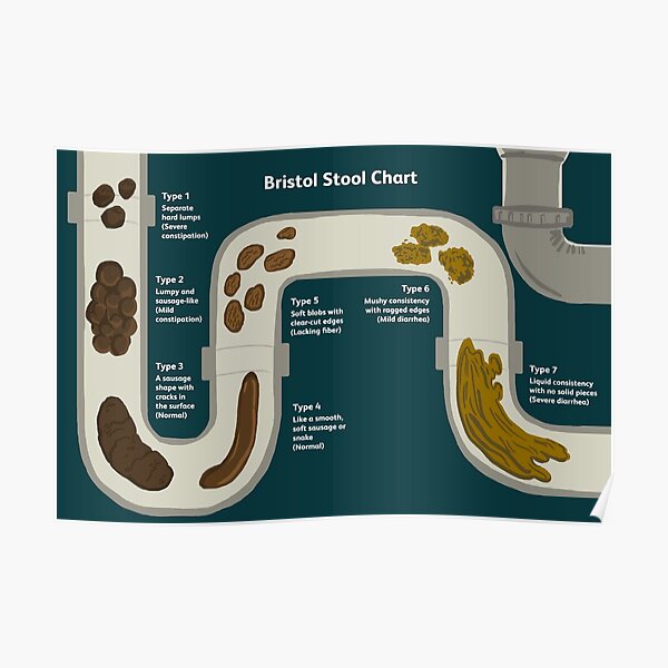 "Bristol stool chart" Poster for Sale by Glinda-39 | Redbubble