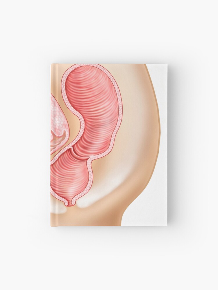 Fistule recto-vaginale et coupe transversale des organes reproducteurs  femelles. | Carnet
