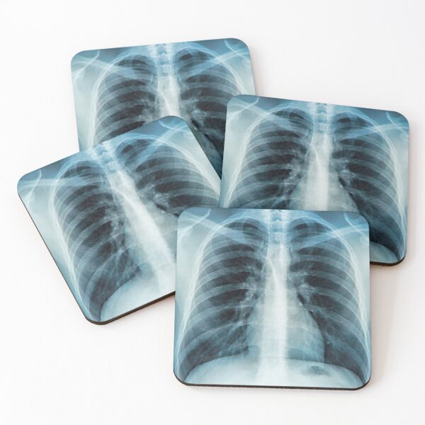 Item preview, Chest X Ray Picture designed and sold by ramazis.