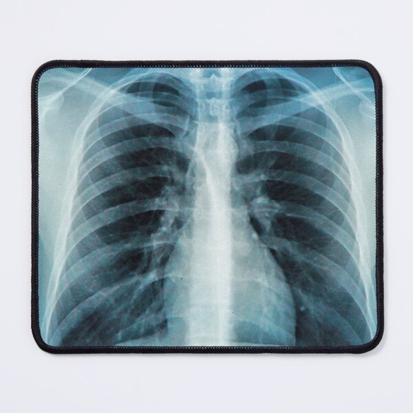 Item preview, Chest X Ray Picture designed and sold by ramazis.