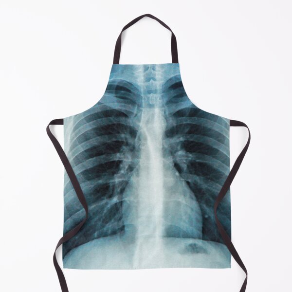 Item preview, Chest X Ray Picture designed and sold by ramazis.