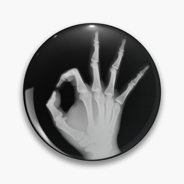 Item preview, X Ray of Human Hand OK designed and sold by ramazis.
