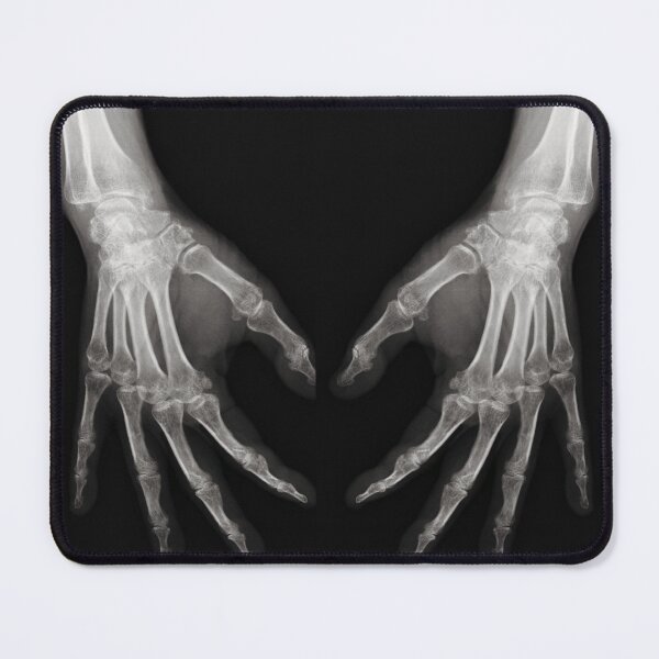 Item preview, X ray of hands designed and sold by ramazis.