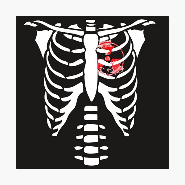 Item preview, Radiology You Pose We Expose with X-ray t-shirt rad tech designed and sold by Rida Faiz.