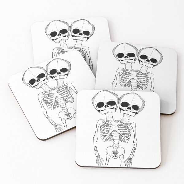 Item preview, Conjoined Twin Skeleton designed and sold by cryptcreations.