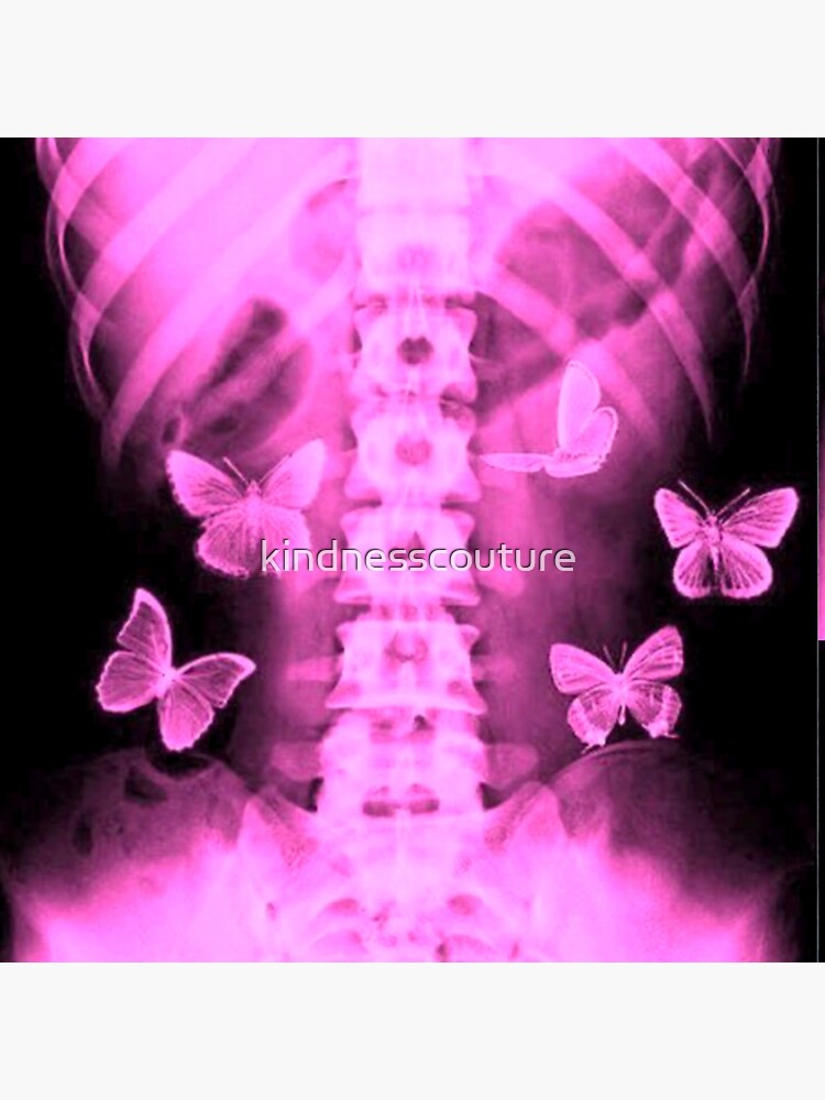 BUTTERFLIES IN MY STOMACH by kindnesscouture