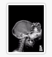 Infected X-Ray Sticker