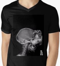 Infected X-Ray V-Neck T-Shirt