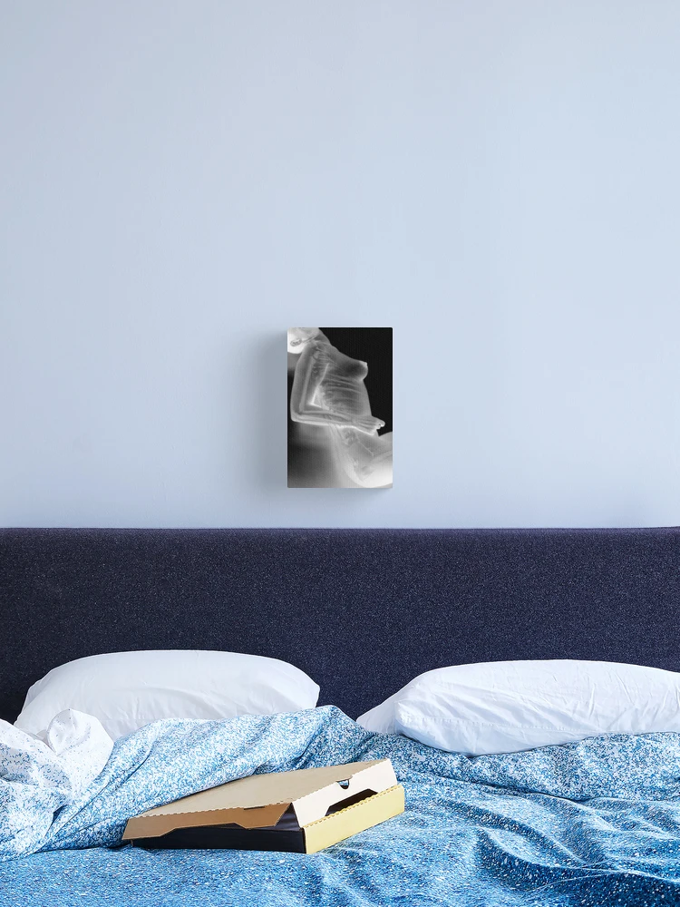 Thumbnail 2 of 3, Canvas Print, X-RAY designed and sold by Raul Brzic.