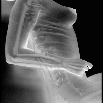 Artwork thumbnail, X-RAY by Raul Brzic