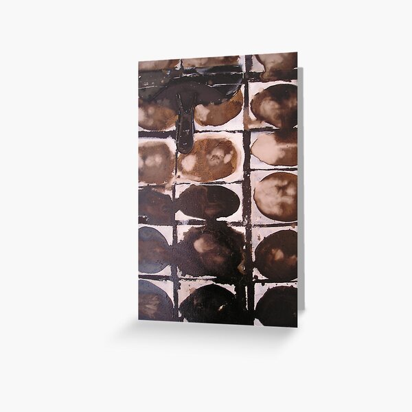 Orifice and Scraper Greeting Card
