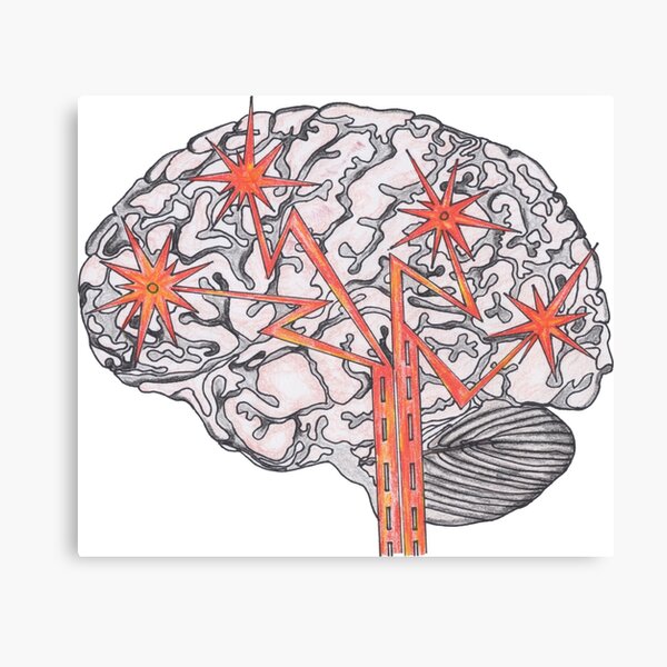Brain Plasticity Canvas Print