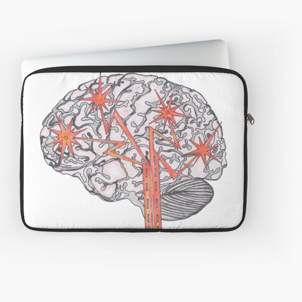 Brain Plasticity Laptop Sleeve