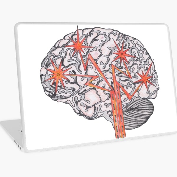 Brain Plasticity Laptop Skin