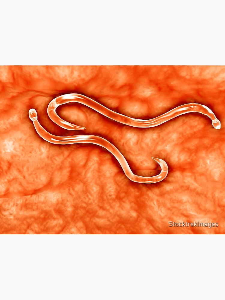 Hookworms, illustration - Stock Image - C034/2667 - Science Photo Library