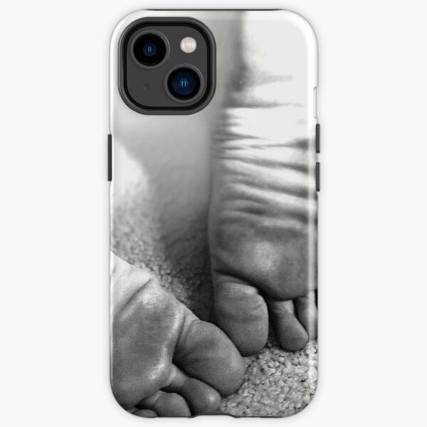 Bare Feet Soles Phone Cases for Sale