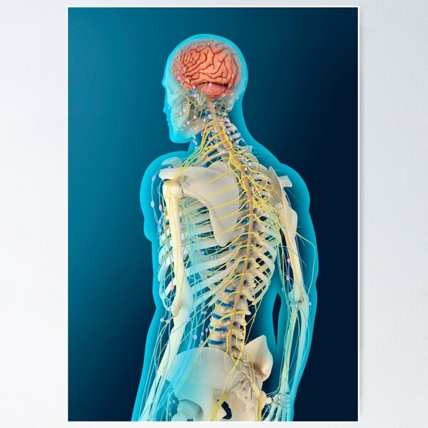 Medical illustration detailing thoracic outlet syndrome. Poster