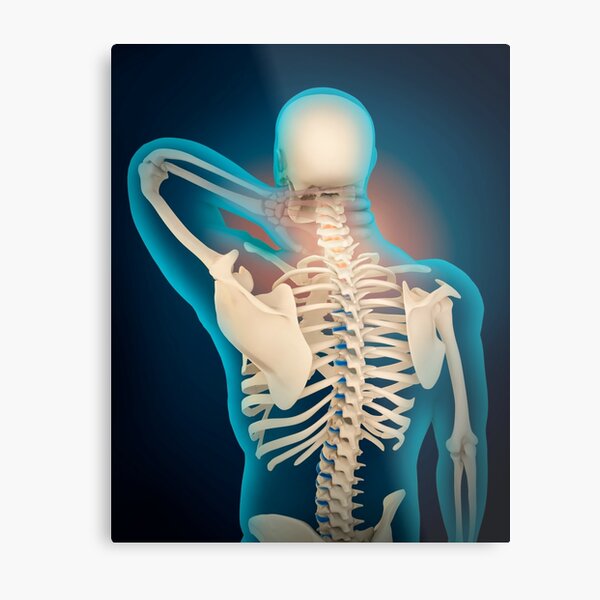 Three dimensional view of female upper back and skeletal system. - Album  alb3882670