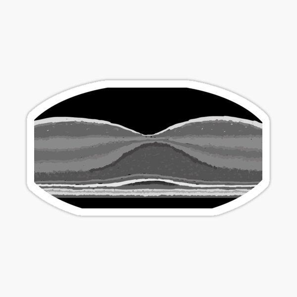 Item preview, OCT Retinal Scan designed and sold by TheEyeFanatic.