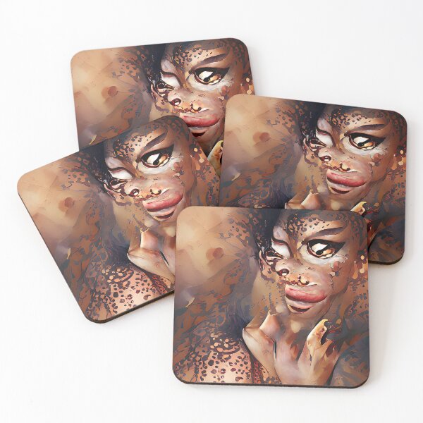 Item preview, Vitiligo Winter designed and sold by PlacidHinds.