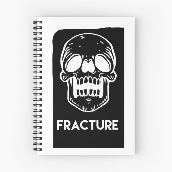 Item preview, Fracture designed and sold by Dipalo.