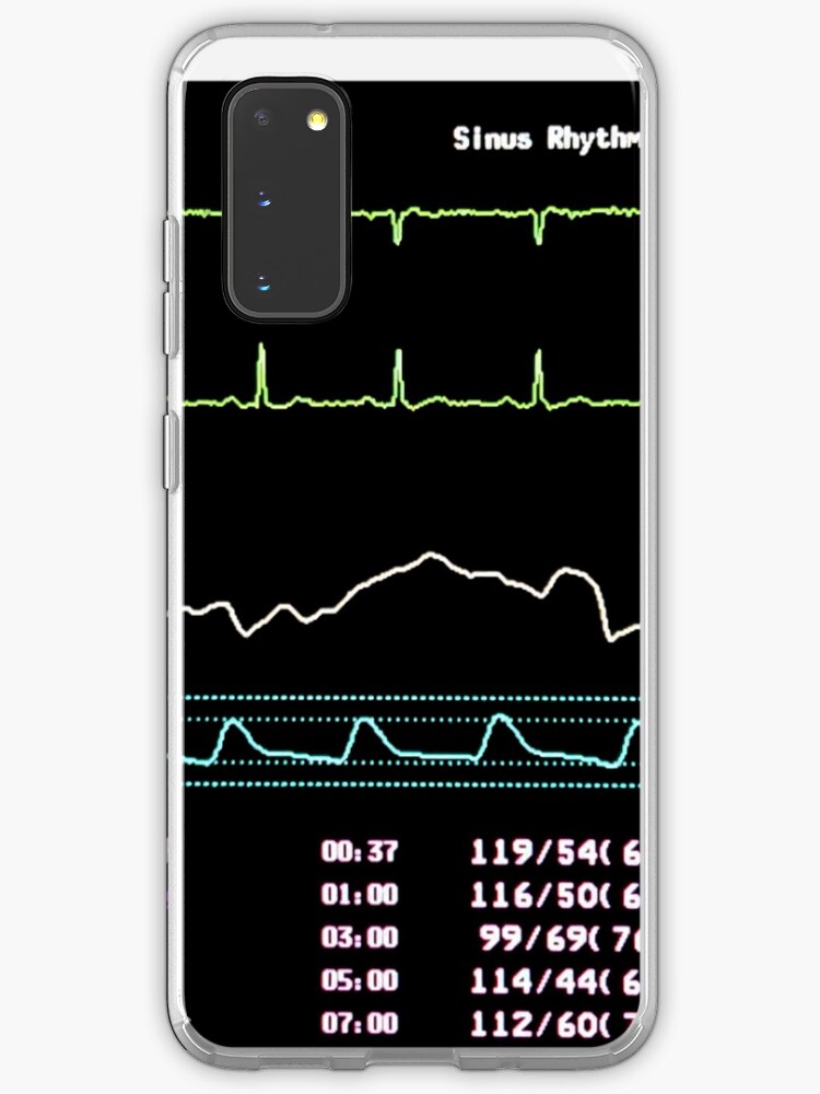Icu Monitor Bildschirm Mit Herzfrequenz Blutdruck Sauerstoffsattigung Und Atemfrequenz Tracing Hulle Klebefolie Fur Samsung Galaxy Von Ggggur Redbubble