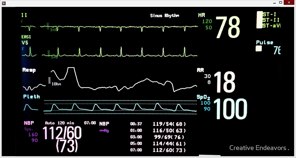 monitor icu heart screen rate oxygen respiratory saturation blood pressure tracings redbubble