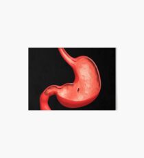 Conceptual image of peptic ulcer in human stomach. Art Board Print