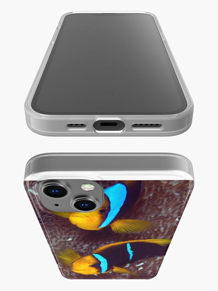 Alternate view of Grumpy couple II iPhone Case