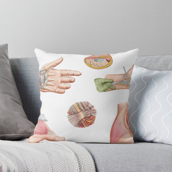Item preview, Medical illustration showing carpal tunnel syndrome in the human wrist. designed and sold by StocktrekImages.