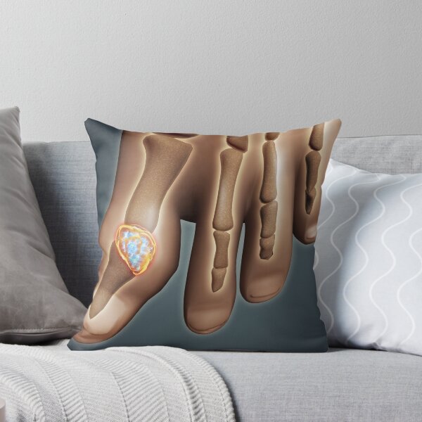 Item preview, Conceptual image of gout in the big toe. designed and sold by StocktrekImages.