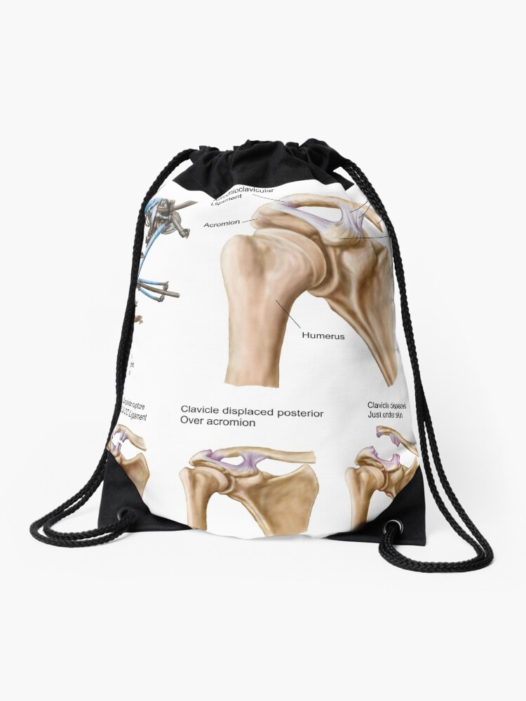 Medical illustration detailing thoracic outlet syndrome. Drawstring Bag  for Sale by StocktrekImages