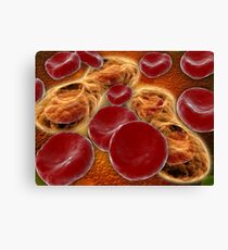 Malaria spores in the human blood stream. Canvas Print