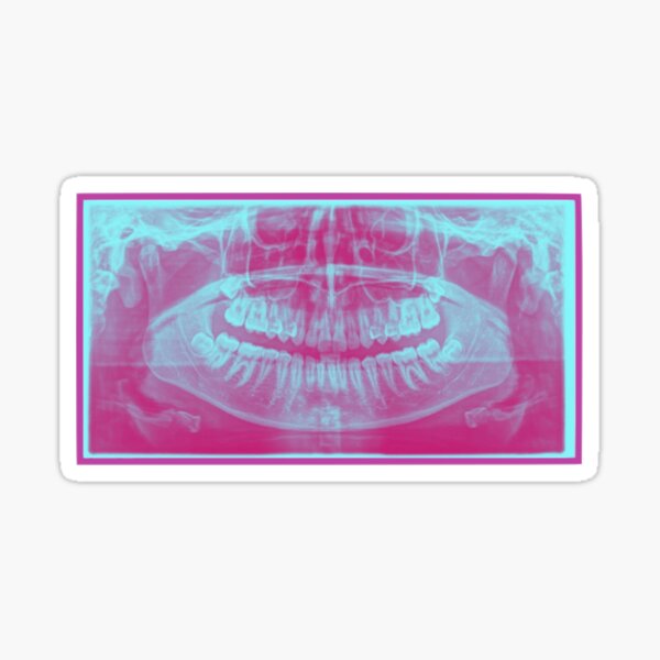 Item preview, Pink Xray designed and sold by HappyToothGirl.