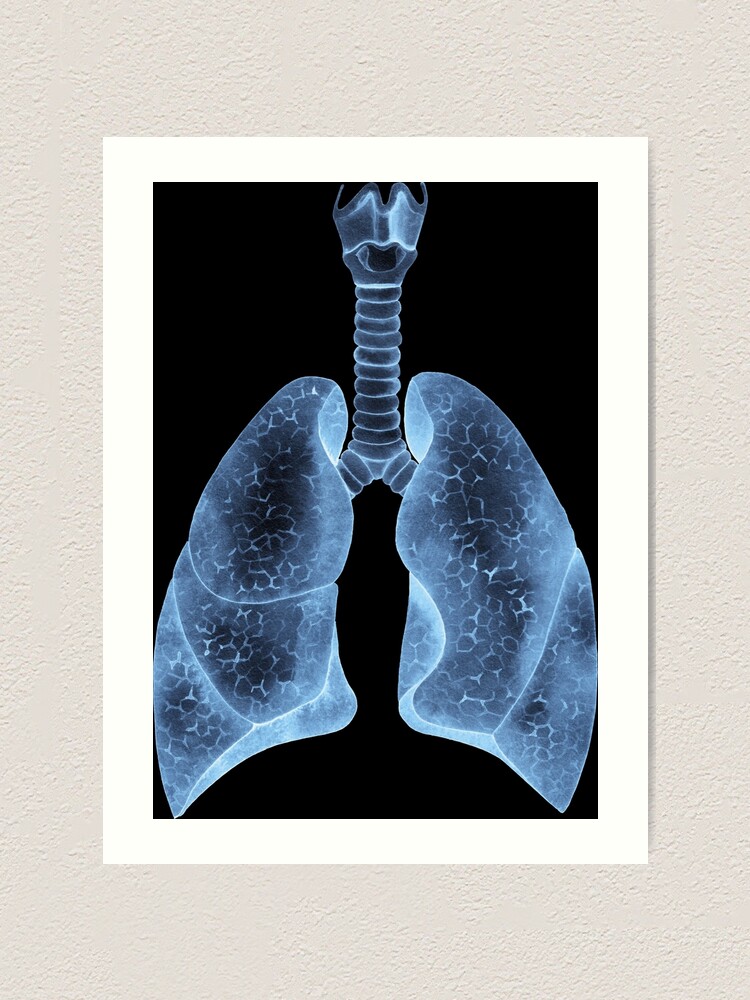 rayos x de pulmones no saludables