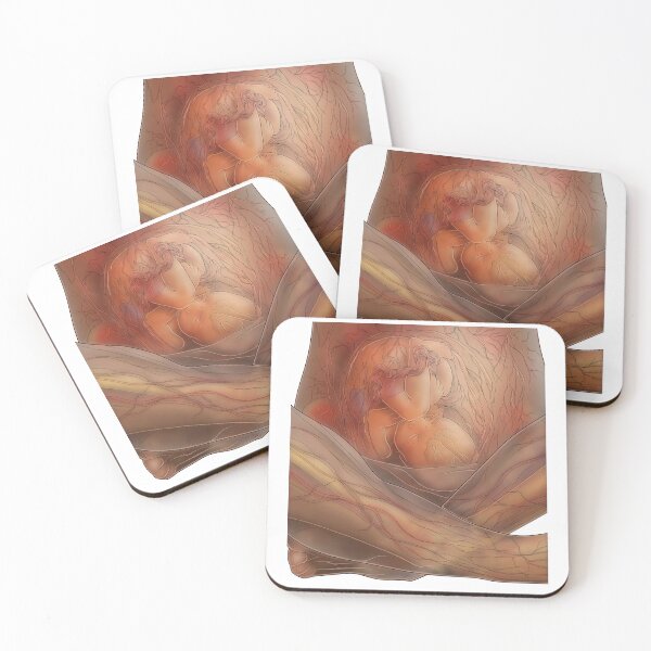 Item preview, Pregnancy designed and sold by TIBOM.