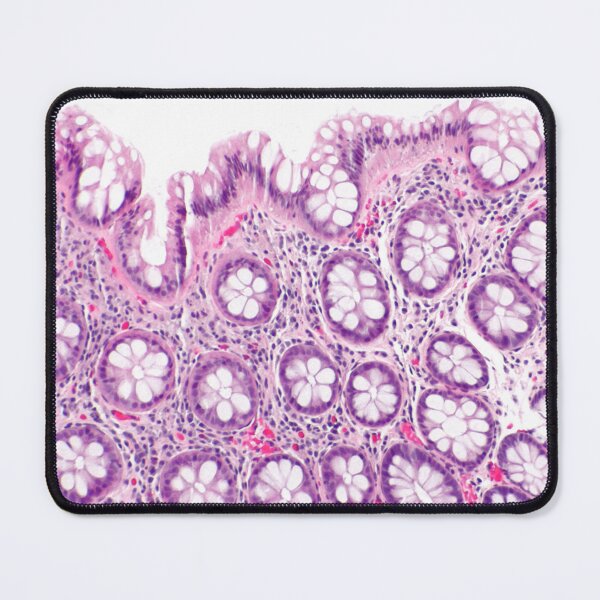 Item preview, Gut Histology designed and sold by deltoid.