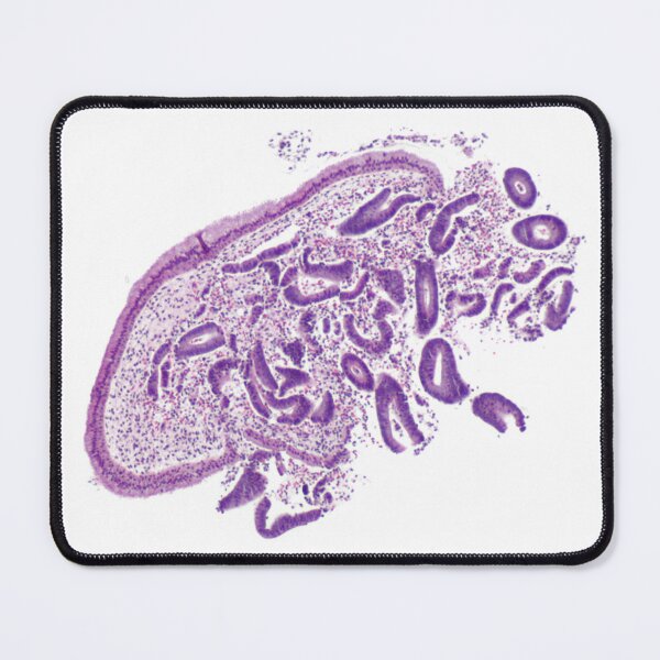 Item preview, Uterus Histology designed and sold by deltoid.