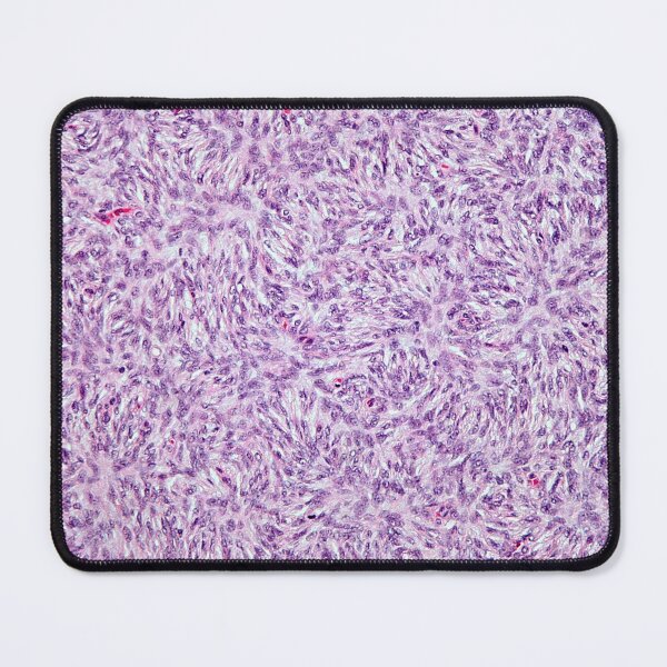 Item preview, Fibroblast Histology designed and sold by deltoid.