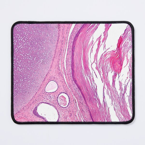Item preview, Teratoma Histology designed and sold by deltoid.