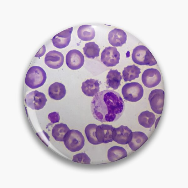 Item preview, Canine Distemper Virus Histology designed and sold by deltoid.