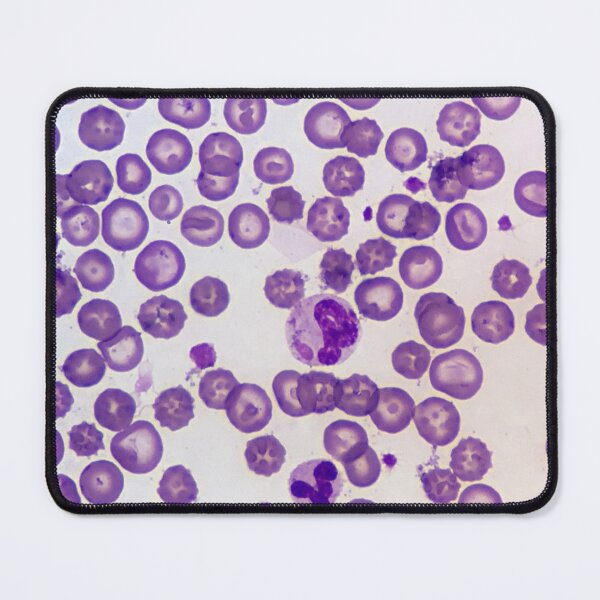 Item preview, Canine Distemper Virus Histology designed and sold by deltoid.