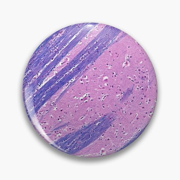 Item preview, Putamen Histology designed and sold by deltoid.
