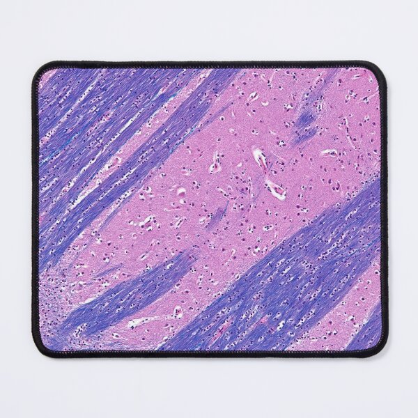 Item preview, Putamen Histology designed and sold by deltoid.