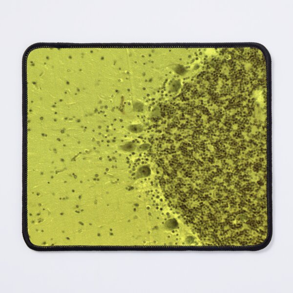 Item preview, Cerebellum Histology designed and sold by deltoid.