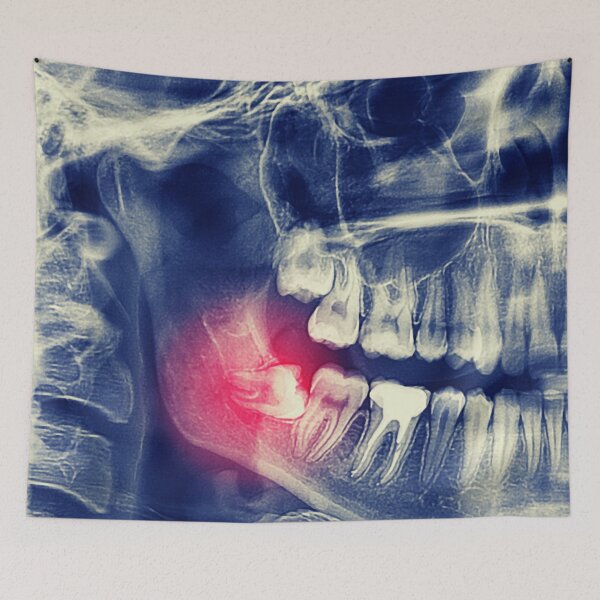 Item preview, DENTAL X-RAY designed and sold by Swooncake Press.