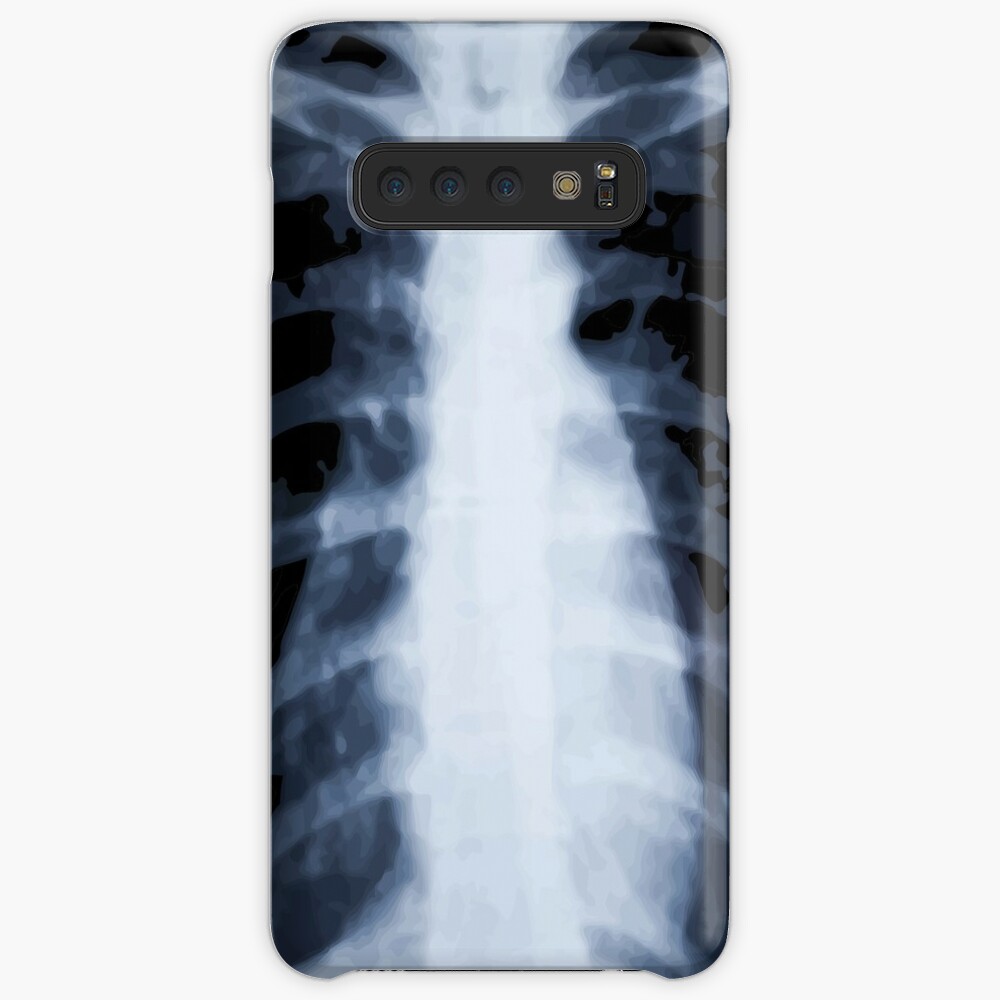 Oddities: X-Ray Samsung S10 Case