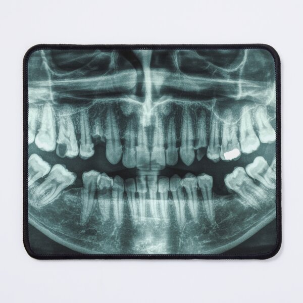 Item preview, X ray teeth scan designed and sold by Delicarte.